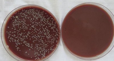 Eosin Methylene Blue plate