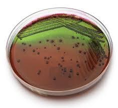 Eosin Methylene Blue with colonies
