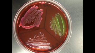 Campylobacter agar plate