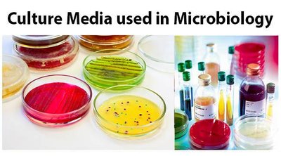 Culture media used in microbiology