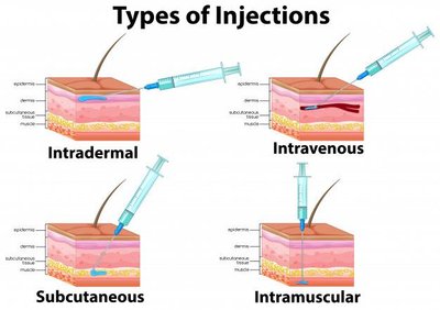 Types of injections: intradermal, intravenous, subcutaneous, intramuscular