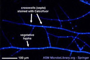 Fluorescent micrograph of septate hyphae