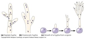 Diagram of septate and coenocytic hyphae