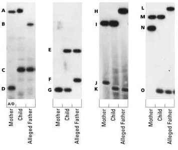 DNA fingerprinting gel for identification