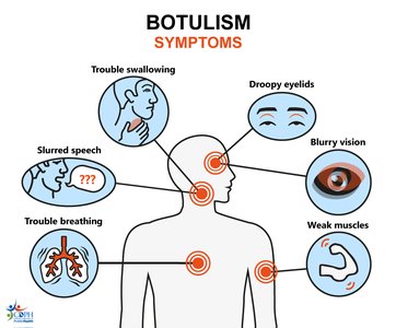 Symptoms of botulism