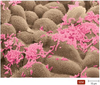 Resident microbiota in the human intestine