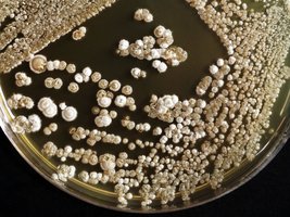 Streptomyces colonies on agar plate