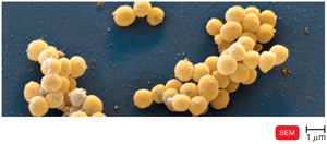 Staphylococcus SEM image