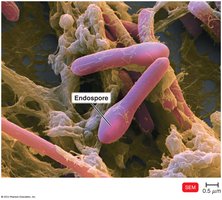 Clostridium endospore SEM