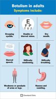Botulism symptoms infographic