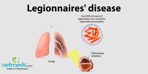 Legionnaires' disease diagram