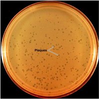 Bacteriophage plaques on agar plate