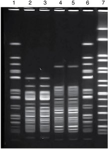 DNA fingerprinting gel