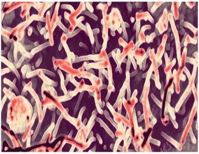 Electron micrograph of Ebola virus particles
