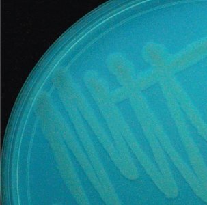 Blue-green pigment produced by Pseudomonas aeruginosa on agar plate