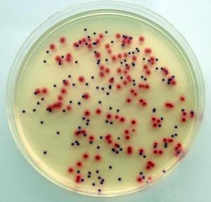 Bacterial colonies on agar plate