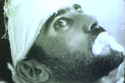 Negri bodies in brain tissue