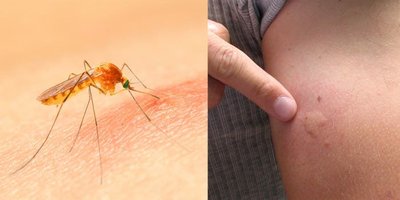 Mosquito bite as arbovirus transmission