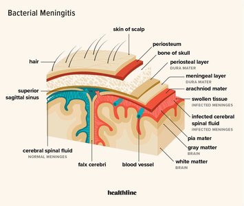 Bacterial meningitis cross-section