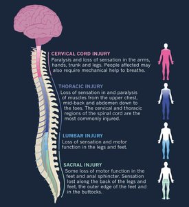Spinal cord injury and affected regions