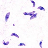 Toxoplasma gondii tachyzoites in tissue