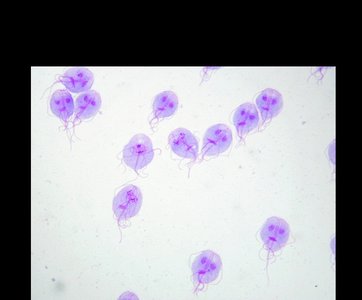 Giardia intestinalis trophozoites stained