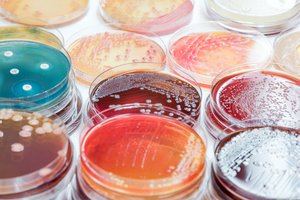 Petri dishes with microbial cultures