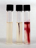 Motility medium: Uninoculated (left), nonmotile S. aureus (center), motile P. aeruginosa (right)