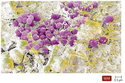 SEM of dental plaque biofilm