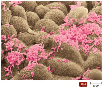 SEM of normal microbiota on human tissue