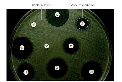 Kirby-Bauer test with zones of inhibition
