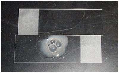 Catalase test reaction