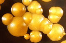 Biofilm structure under microscope