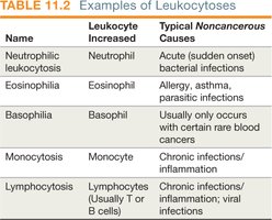 Table of leukocytoses