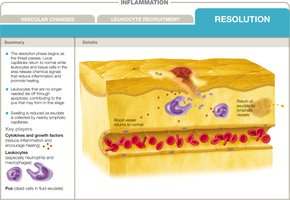 Resolution phase of inflammation