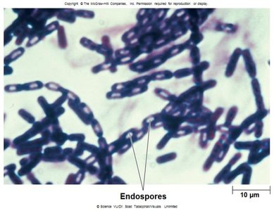 Endospores under microscope