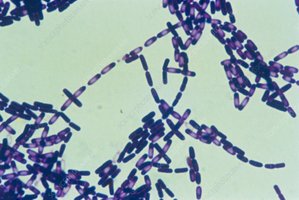 Bacillus subtilis with endospores under a microscope