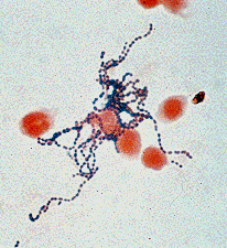 S. pyogenes Gram stain under brightfield microscopy