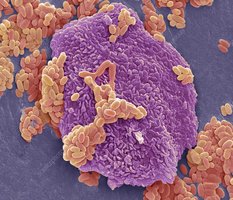 SEM of bacteria from lip, with human cell