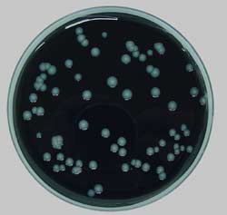 E. coli O157:H7 serotypes in ground beef