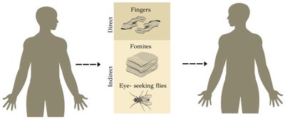 Transmission routes of trachoma: fingers, fomites, and flies