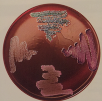 EMB agar plate with different colony colors