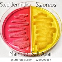 MSA plate showing S. aureus and S. epidermidis