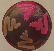 MacConkey agar plate with pink and colorless colonies
