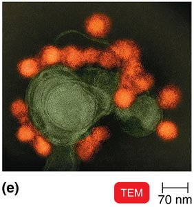 TEM image of viruses