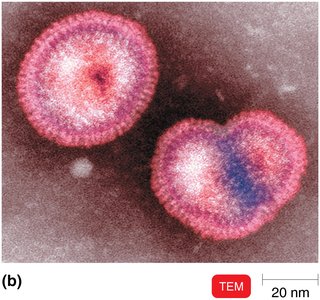 TEM image showing viral spikes