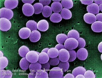 SEM image of Staphylococcus aureus