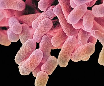 SEM image of rod-shaped bacteria