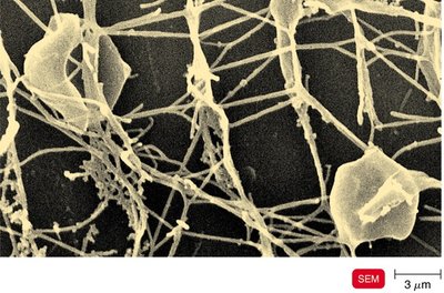 SEM image of archaeal cells