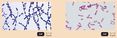 Gram-positive and Gram-negative rods